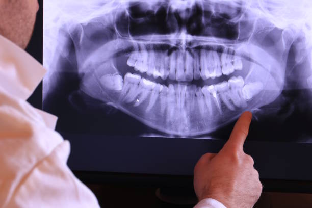 Best Emergency Tooth Extraction in Barrett, TX
