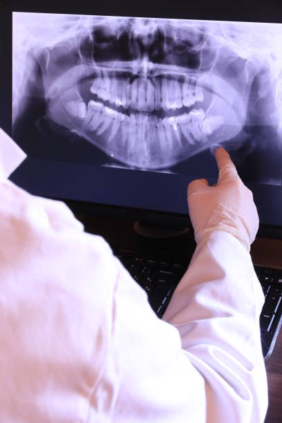 Best Emergency Wisdom Teeth Removal in Barrett, TX