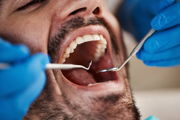 Best Walk-In Emergency Dentist in Barrett, TX